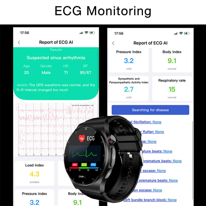  ecg monitoring