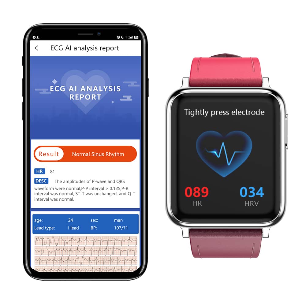 Normal watch 2025 with step counter